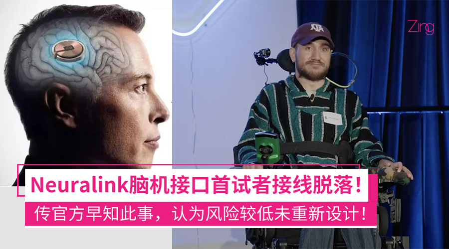 脑机接口首试者接线脱落：Neuralink曾评估风险低 不值得重新设计